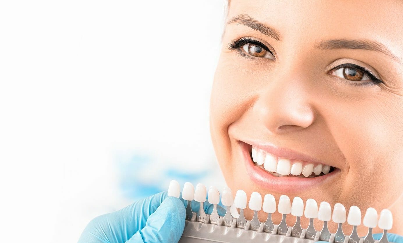 Benefits of Teeth Whitening